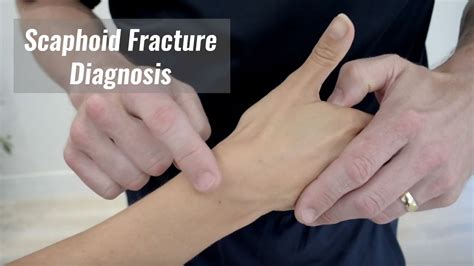 scaphoid pain test